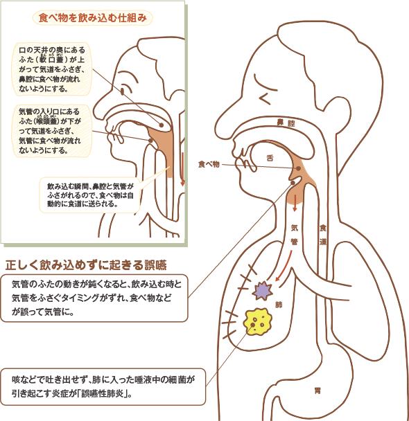 食べ物を飲み込む仕組み 口の天井の奥にあるふた（軟口蓋）なんこうがい が上がって気道をふさぎ、鼻腔に食べ物が流れないようにする。
気管の入り口にあるふた（喉頭蓋）こうとうがい が下がって気道をふさぎ、気管に食べ物が流れないようにする。飲み込む瞬間、鼻腔と気管がふさがれるので、食べ物は自動的に食道に送られる。正しく飲み込めずに起きる誤嚥 
気管のふたの動きが鈍くなると、飲み込む時と気管をふさぐタイミングがずれ、食べ物などが誤って気管に。咳などで吐き出せず、肺に入った唾液中の細菌が引き起こす炎症が「誤嚥性肺炎」。